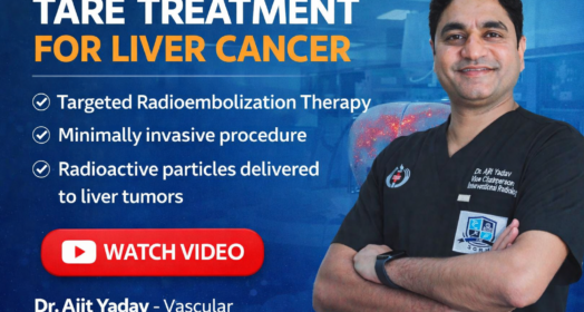 TARE Treatment In Delhi