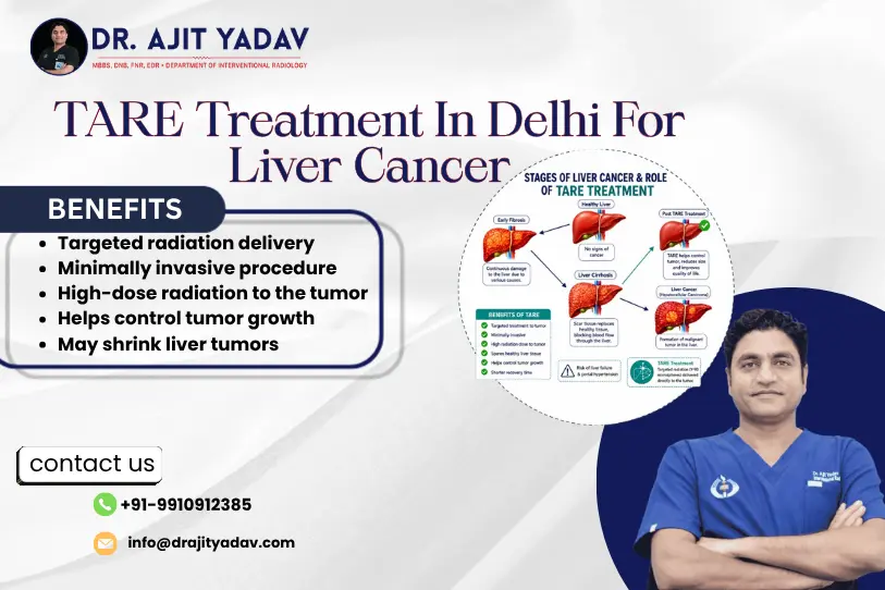 TARE Treatment In Delhi For Liver Cancer: A Targeted, Minimally Invasive Option 5 TARE Treatment
