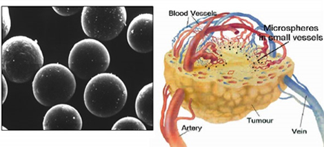 Liver Tumor Treatment In Delhi