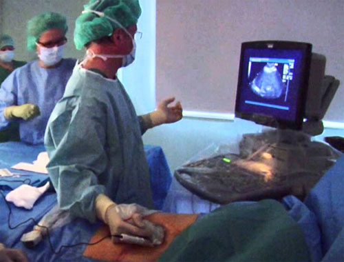 Liver Tumor Treatment In Delhi