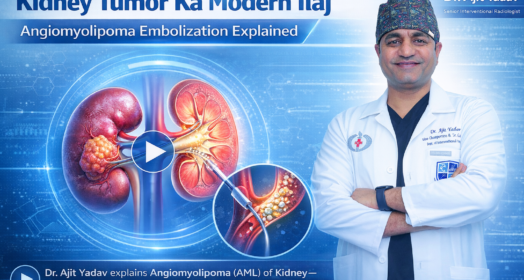 Angiomyolipoma Embolization in Delhi