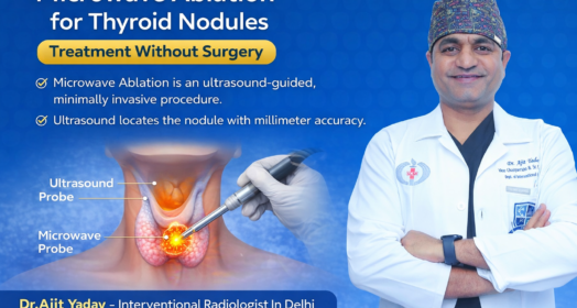 Microwave Ablation for Thyroid Nodules in Delhi