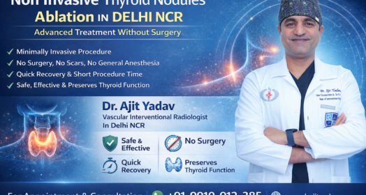 Non Invasive Thyroid Nodules Ablation in Delhi NCR