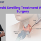 Thyroid Swelling Treatment Without Surgery 85x85