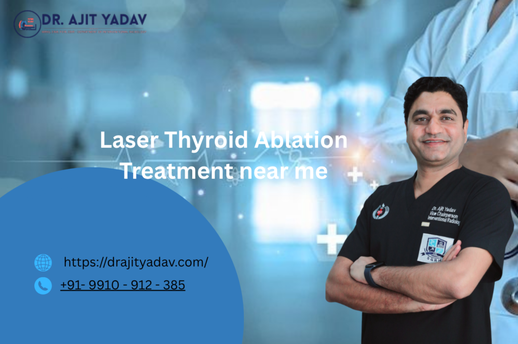 Laser Thyroid Ablation Treatment in Delhi