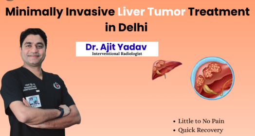 Minimally Invasive Liver Tumor Treatment in Delhi