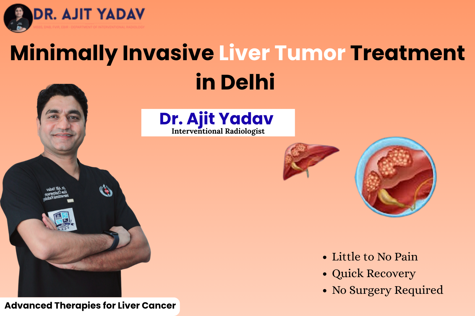 Minimally Invasive Liver Tumor Treatment in Delhi