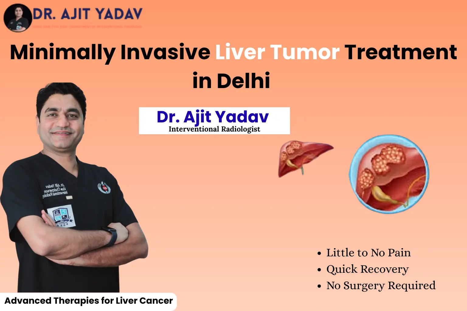 Minimally Invasive Liver Tumor Treatment in Delhi 3 Minimally Invasive Liver Tumor Treatment in Delhi
