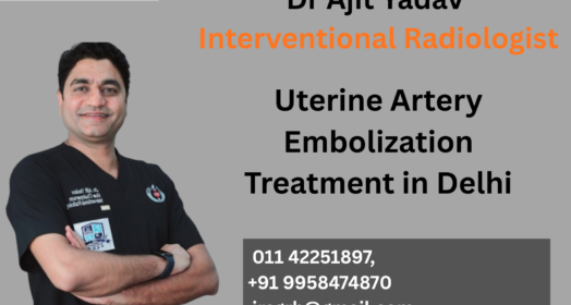 Uterine Artery Embolization Treatment in Delhi, India