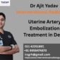 Uterine Artery Embolization Treatment in Delhi 85x85