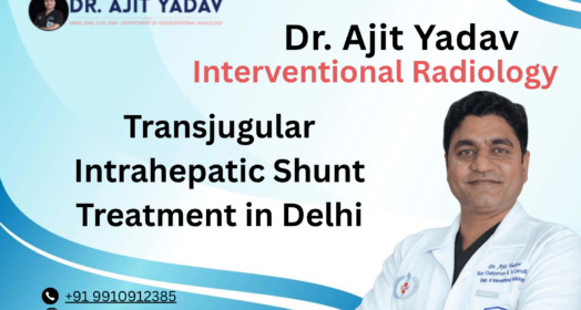 Transjugular Intrahepatic Shunt Treatment in Delhi