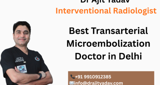 Transarterial Microembolization Doctor in Delhi