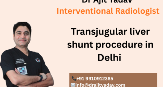 Transjugular liver shunt procedure in delhi