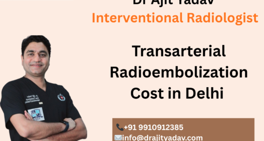 Best Transarterial Radioembolization Cost in Delhi