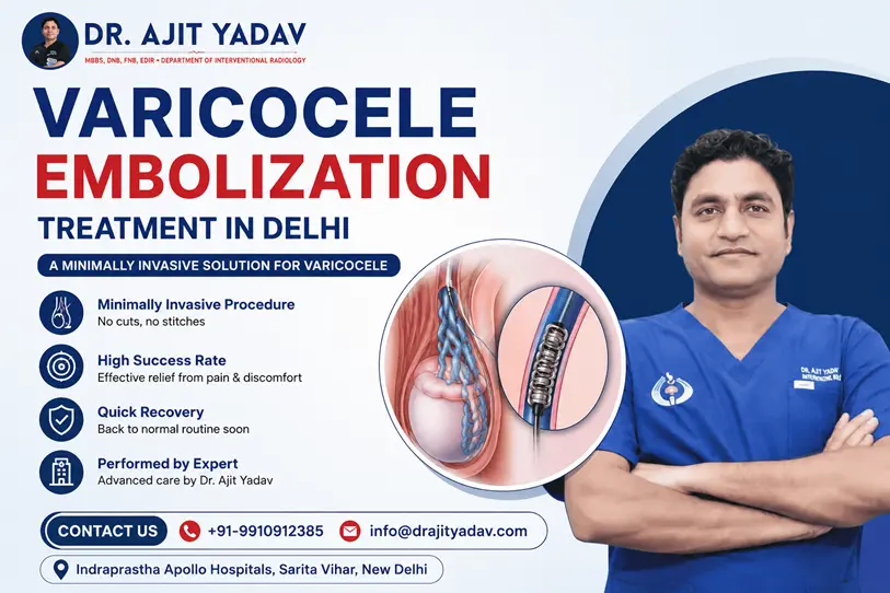 Best Varicocele Embolization Treatment in Delhi
