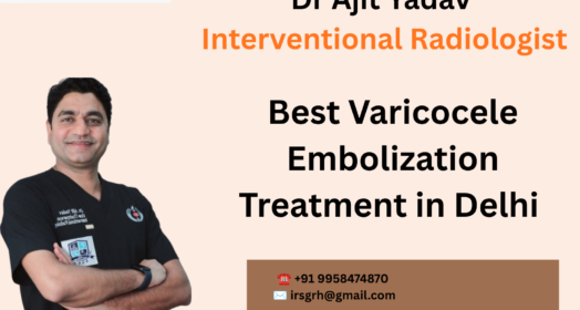 Best Varicocele Embolization Treatment in Delhi