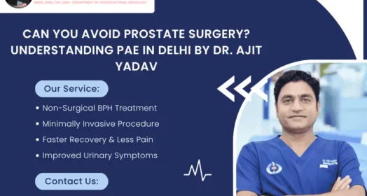 Prostatic Artery Embolization (PAE)