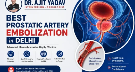 Best Prostatic Artery Embolization in Delhi