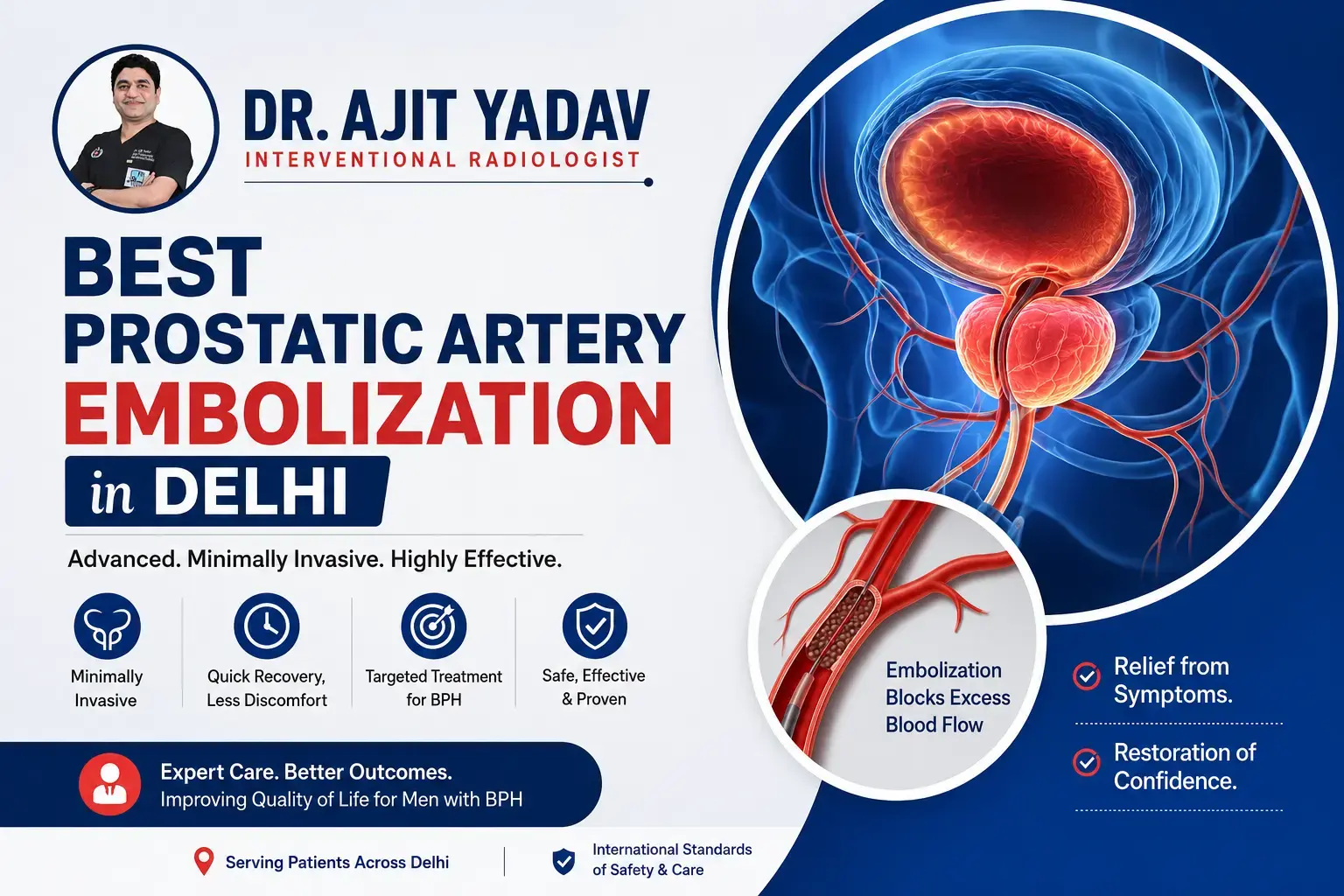 Best Prostatic Artery Embolization in Delhi 1 Best Prostatic Artery Embolization in Delhi