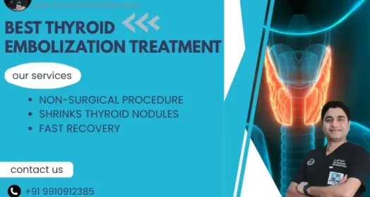 Thyroid Embolization Treatment in Delhi