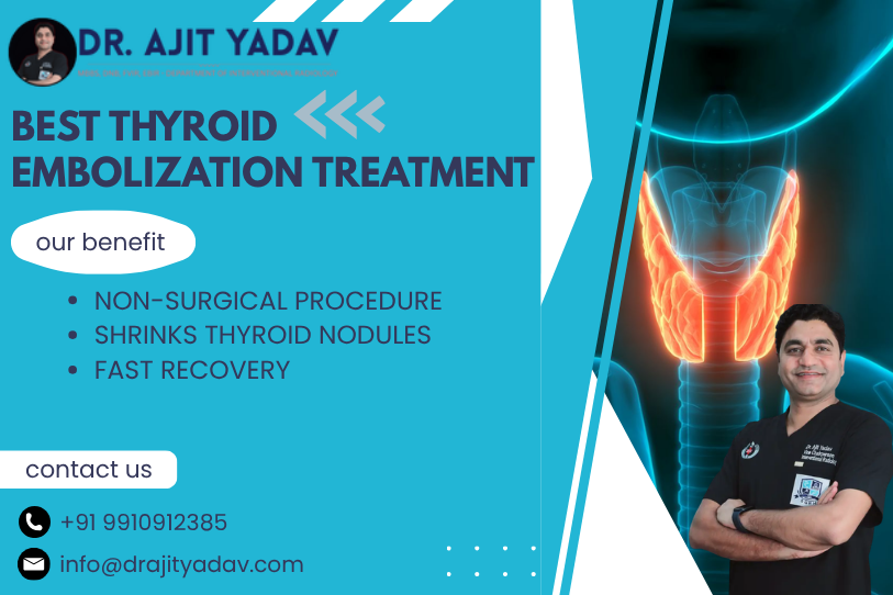 Best Thyroid Embolization Treatment in Delhi 1 Thyroid Embolization Treatment in Delhi
