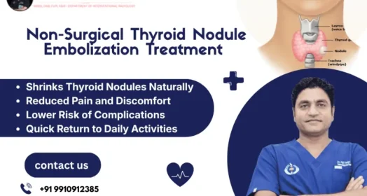 Non-Surgical Thyroid Nodule Embolization Treatment