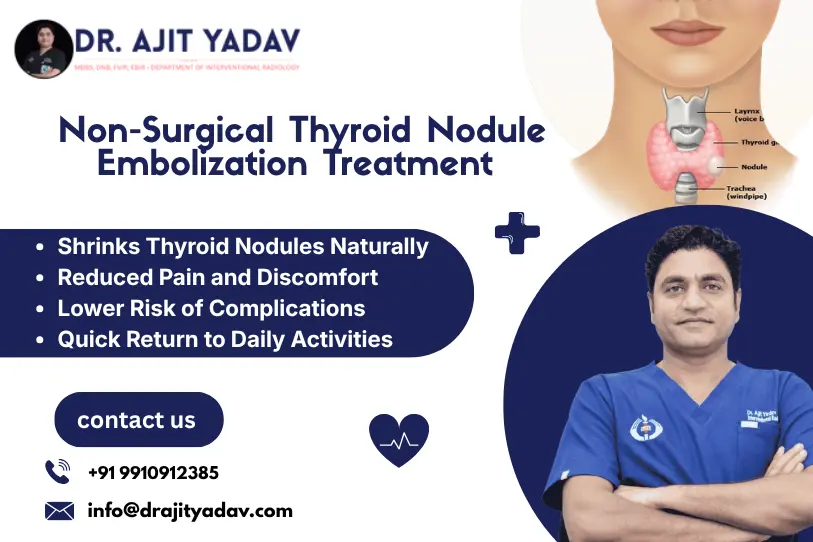 Non-Surgical Thyroid Nodule Embolization Treatment