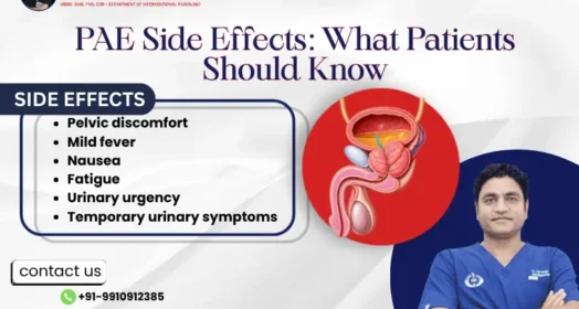 Prostatic Artery Embolization Side Effects