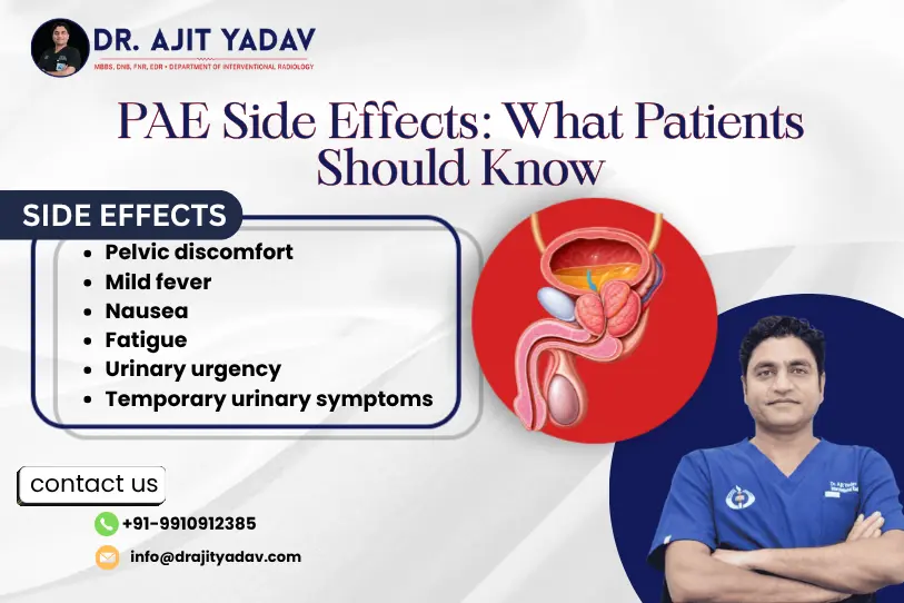 Prostatic Artery Embolization Side Effects: What You Need to Know 1 Prostatic Artery Embolization Side Effects