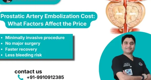 Prostatic Artery Embolization Cost