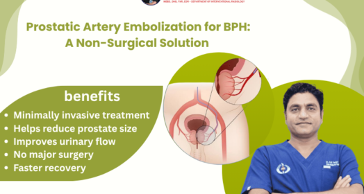 Prostatic Artery Embolization for BPH
