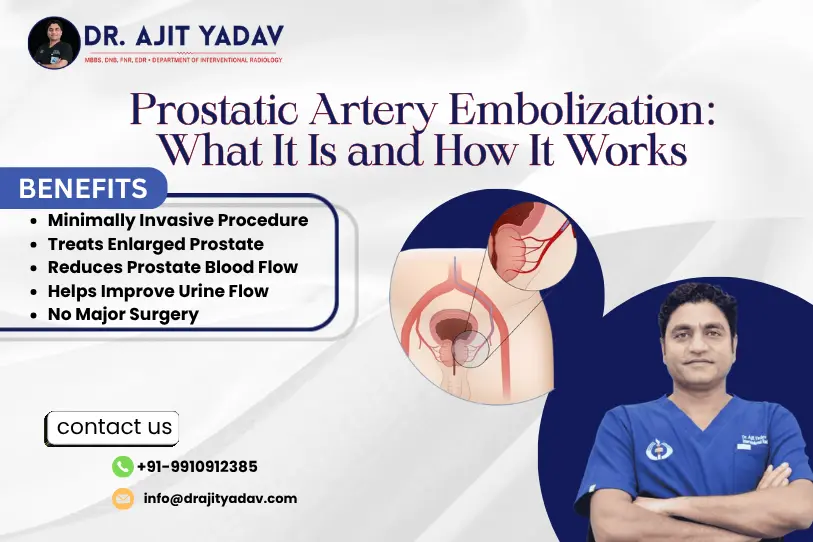 Prostatic Artery Embolization: What It Is and How It Works 1 Prostatic Artery Embolization: How It Works
