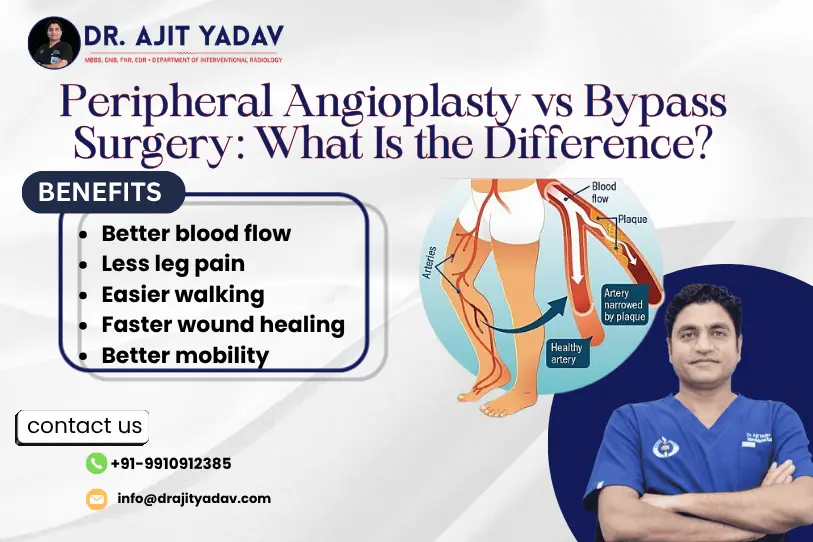 Peripheral Angioplasty vs Bypass Surgery: What Is the Difference? 1 Peripheral Angioplasty vs Bypass Surgery