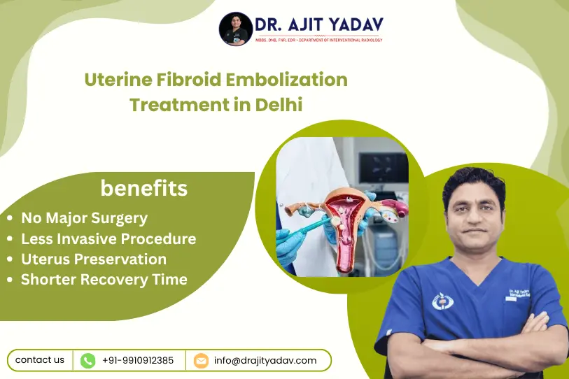 Uterine Fibroid Embolization Treatment in Delhi 5 Uterine Fibroid Embolization Treatment in Delhi