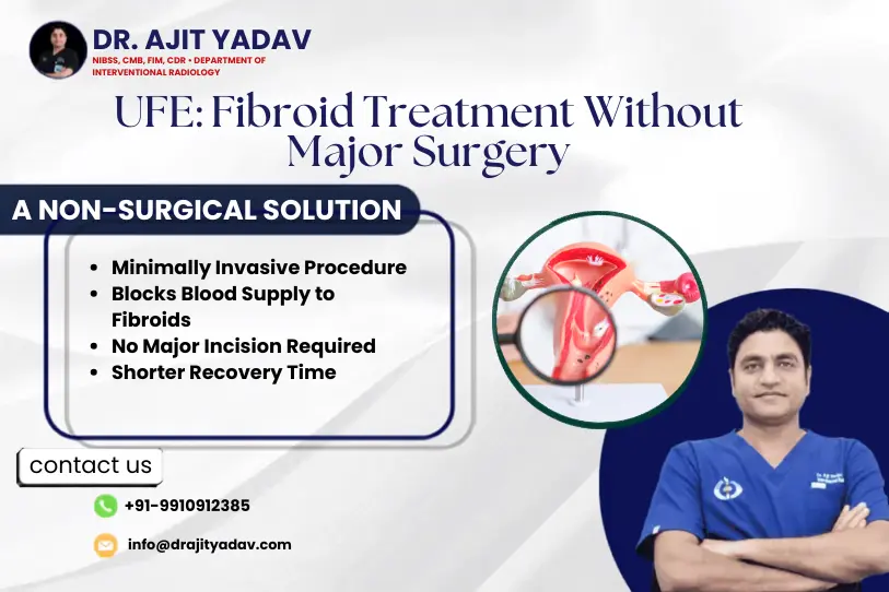 Uterine Fibroid Embolization (UFE): Treatment Without Major Surgery 1 UFE Treatment Without Major Surgery