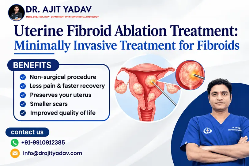 Uterine Fibroid Ablation: Minimally Invasive Treatment for Fibroids 1 Uterine Fibroid Ablation Treatment