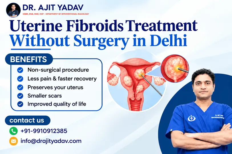 Uterine Fibroids Treatment Without Surgery in Delhi