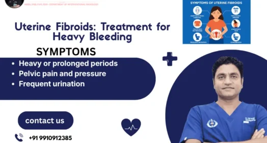 Uterine Fibroid Treatment for Heavy Bleeding: Embolization and Treatment Options