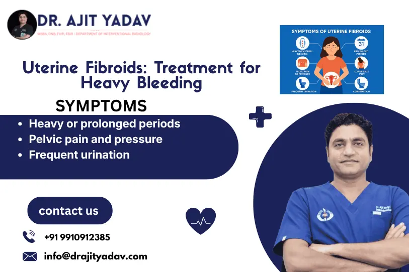 Uterine Fibroid Treatment for Heavy Bleeding: Embolization and Treatment Options