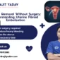 Non Surgical Thyroid Nodule Embolization Treatment 2 85x85