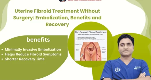Uterine Fibroid Treatment Without Surgery: Embolization, Benefits and Recovery