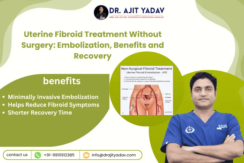 Uterine Fibroid Treatment Without Surgery: Embolization, Benefits and Recovery