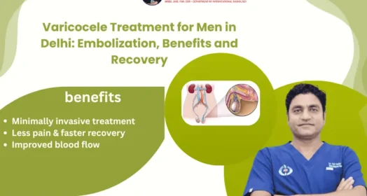 Varicocele Treatment for Men in Delhi: Embolization, Benefits and Recovery